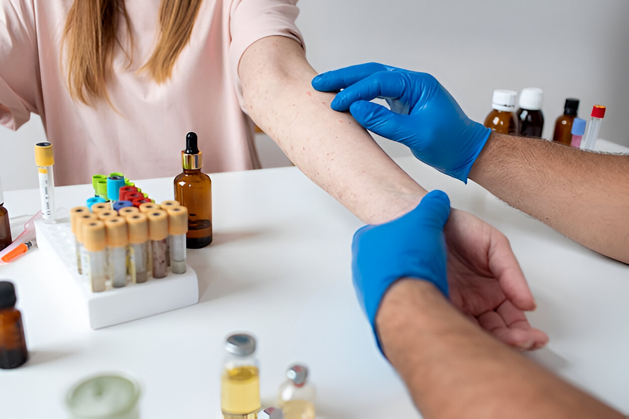 allergy testing