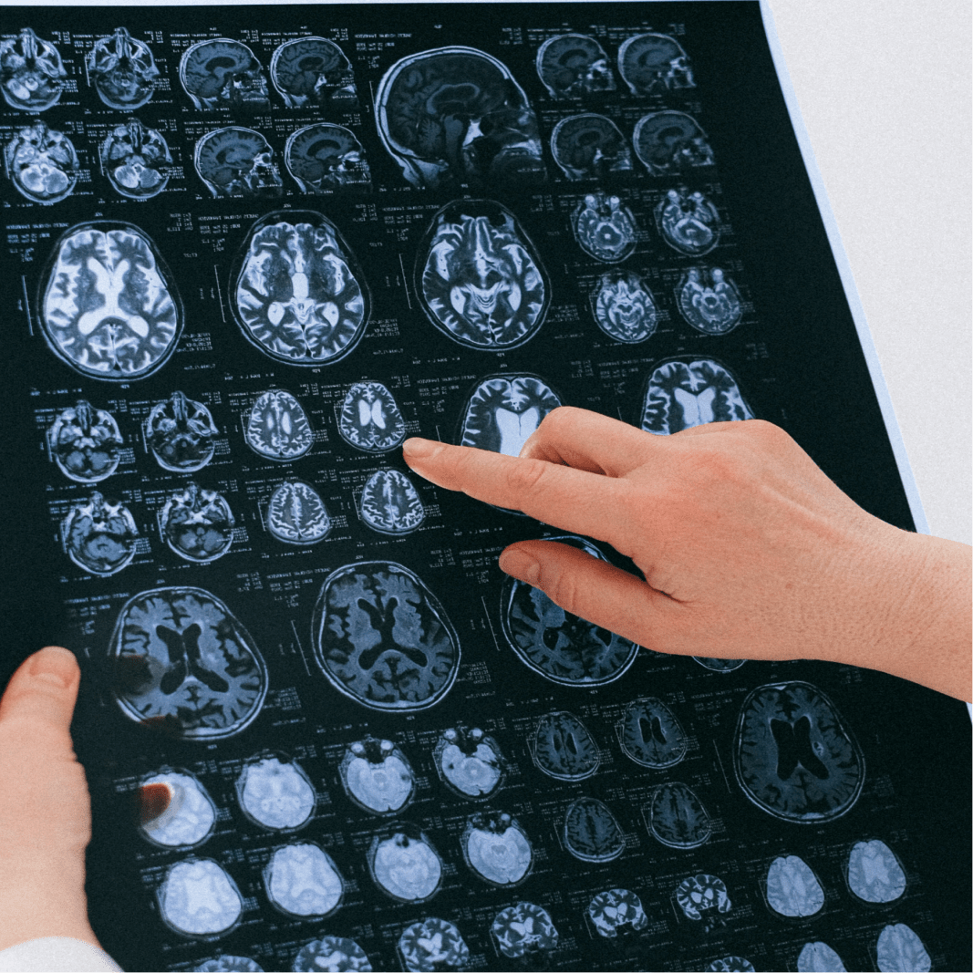 Amanda Carver Psychotherapy and Counselling - Brain Scan Image
