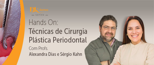 Hands On Técnicas de Cirurgia Plástica Periodontal