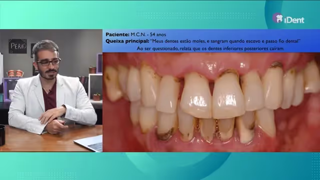 Diagnóstico e Classificação da Periodontite