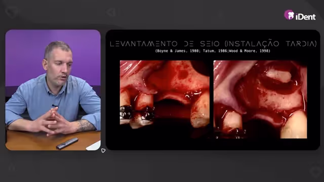 Levantamento de Seio Maxilar