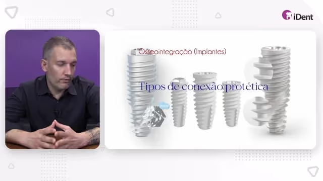 Osseointegração