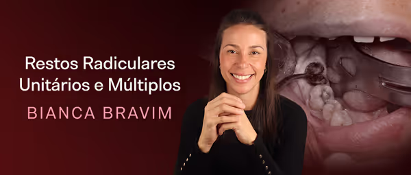 Restos Radiculares Unitários e Múltiplos
