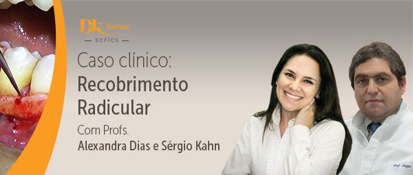 Caso Clínico: Recobrimento Radicular