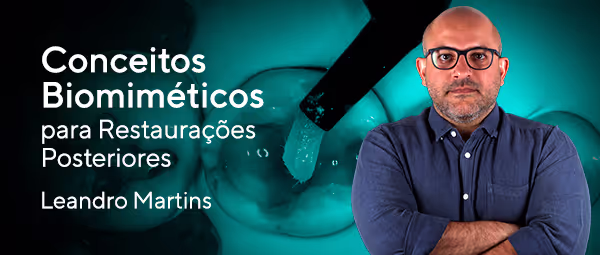 Conceitos Biomiméticos para Restaurações Posteriores