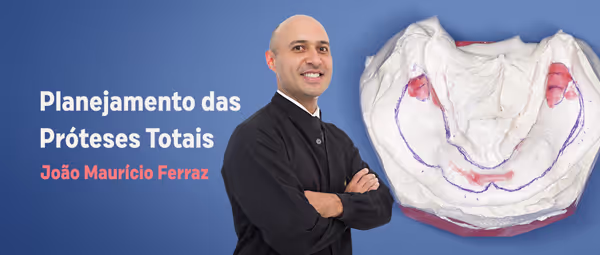 Planejamento das Próteses Totais