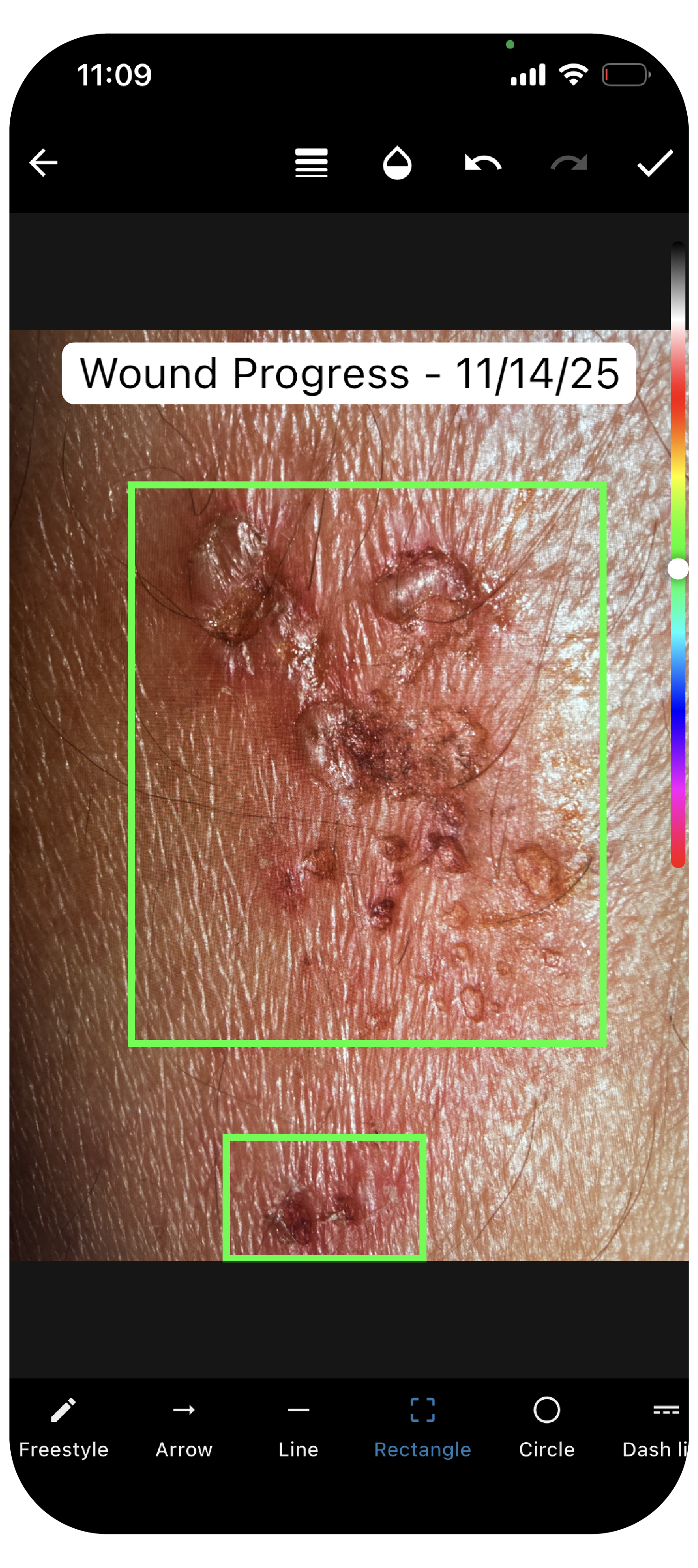 Screenshot of QliqCHAT HIPAA-Compliant Texting App showcasing the ability of capturing and annotating images for better collaboration