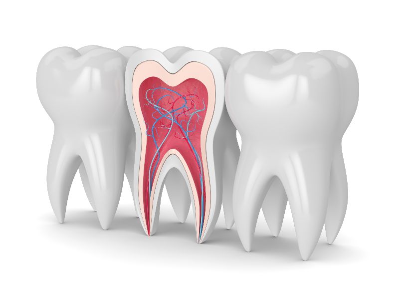 root canal illustration