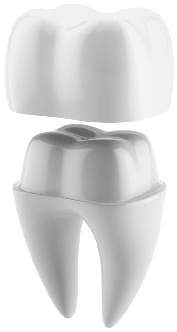 dental crown illustration