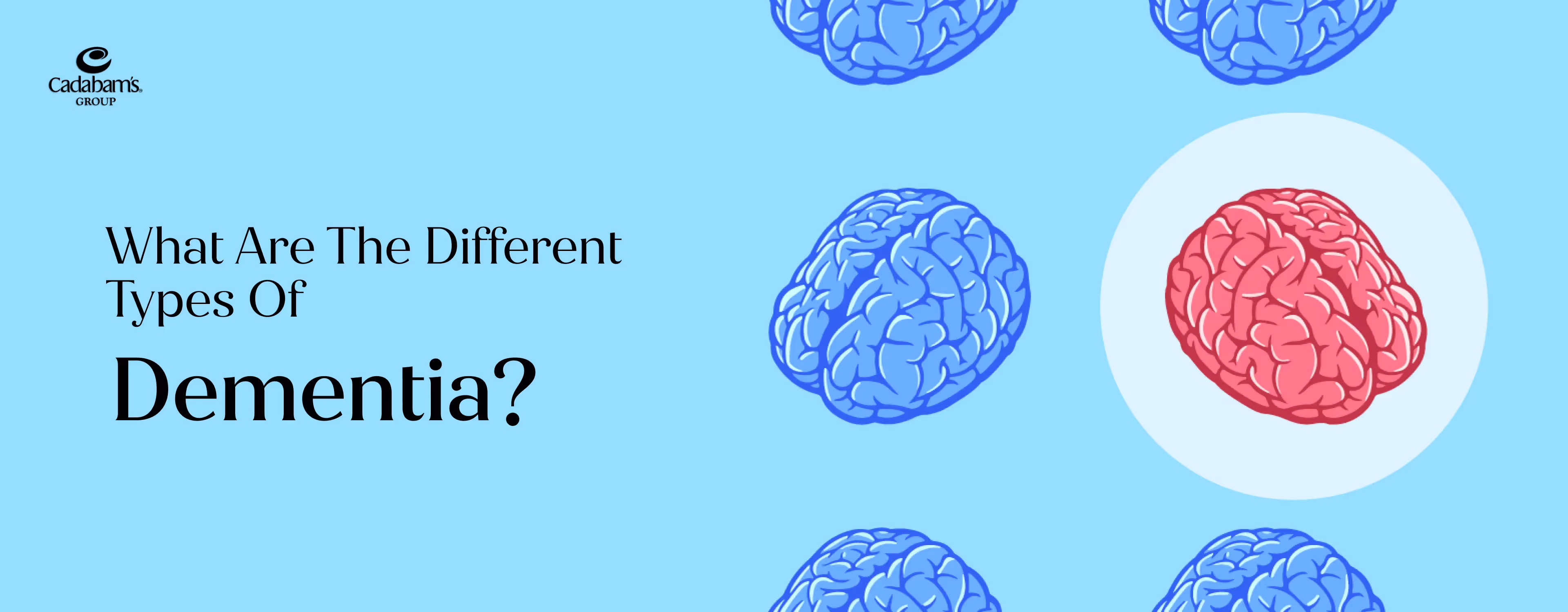 Several brains dealing with different types of dementia. 