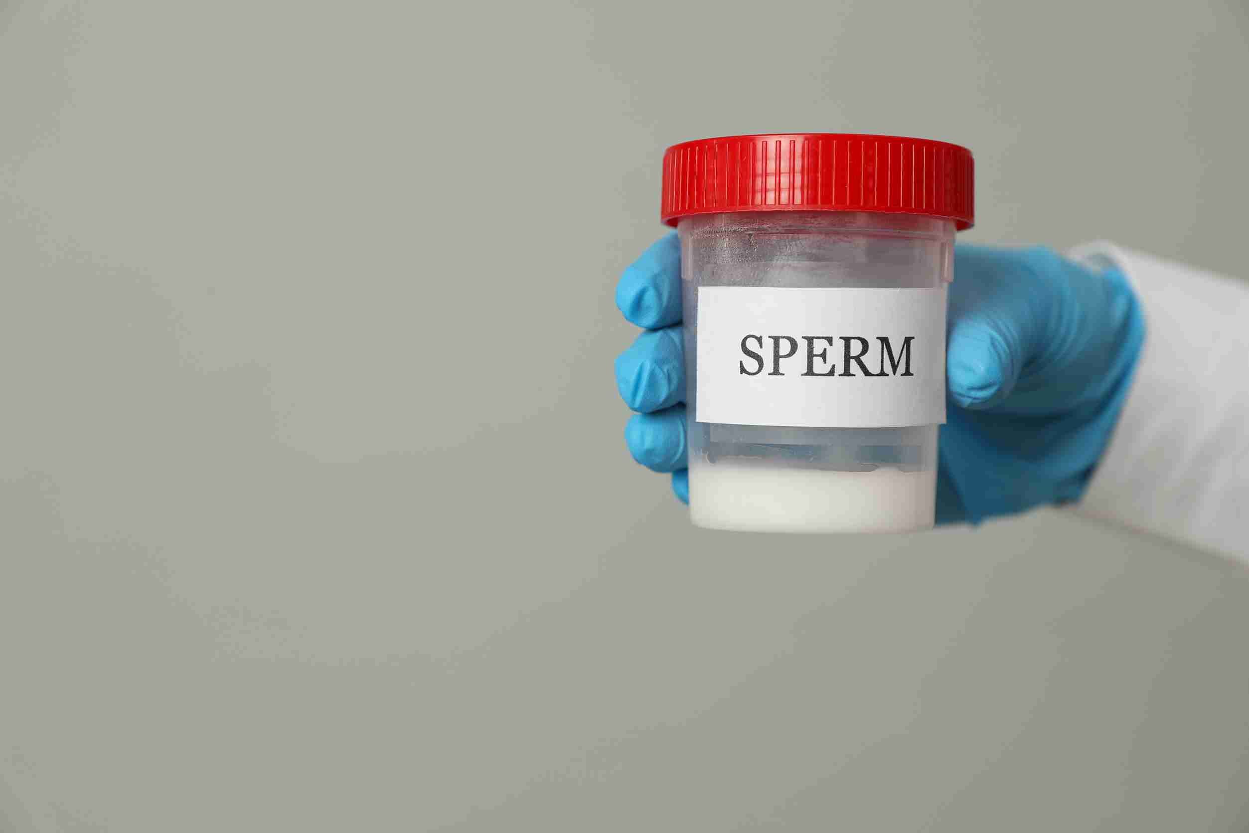 Semen Analysis Explained: What the Report Actually Tells You