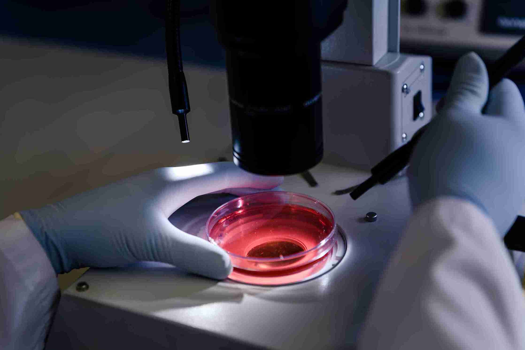 PGT-A vs PGT-M vs PGT-SR - what is the difference?