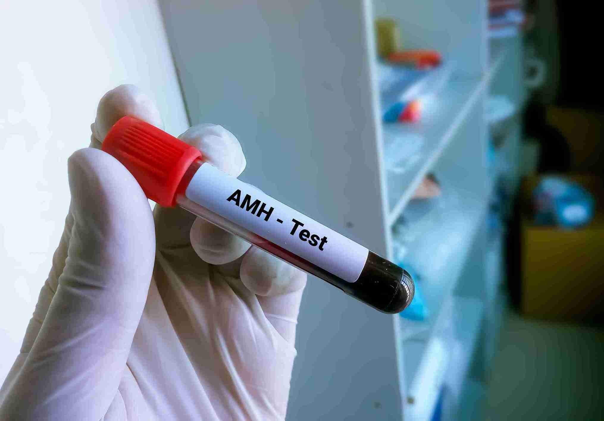 AMH (Anti-Müllerian Hormone) is produced by the small, developing follicles in your ovaries
