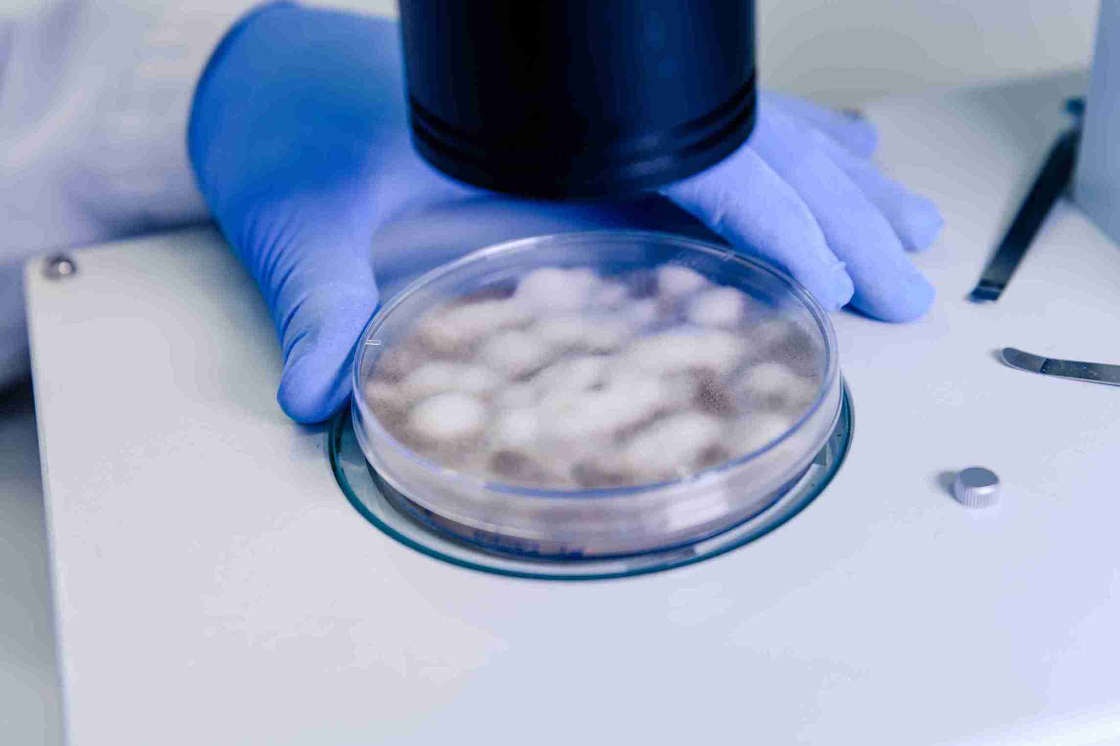 Sperm freezing is worth considering whenever your future fertility