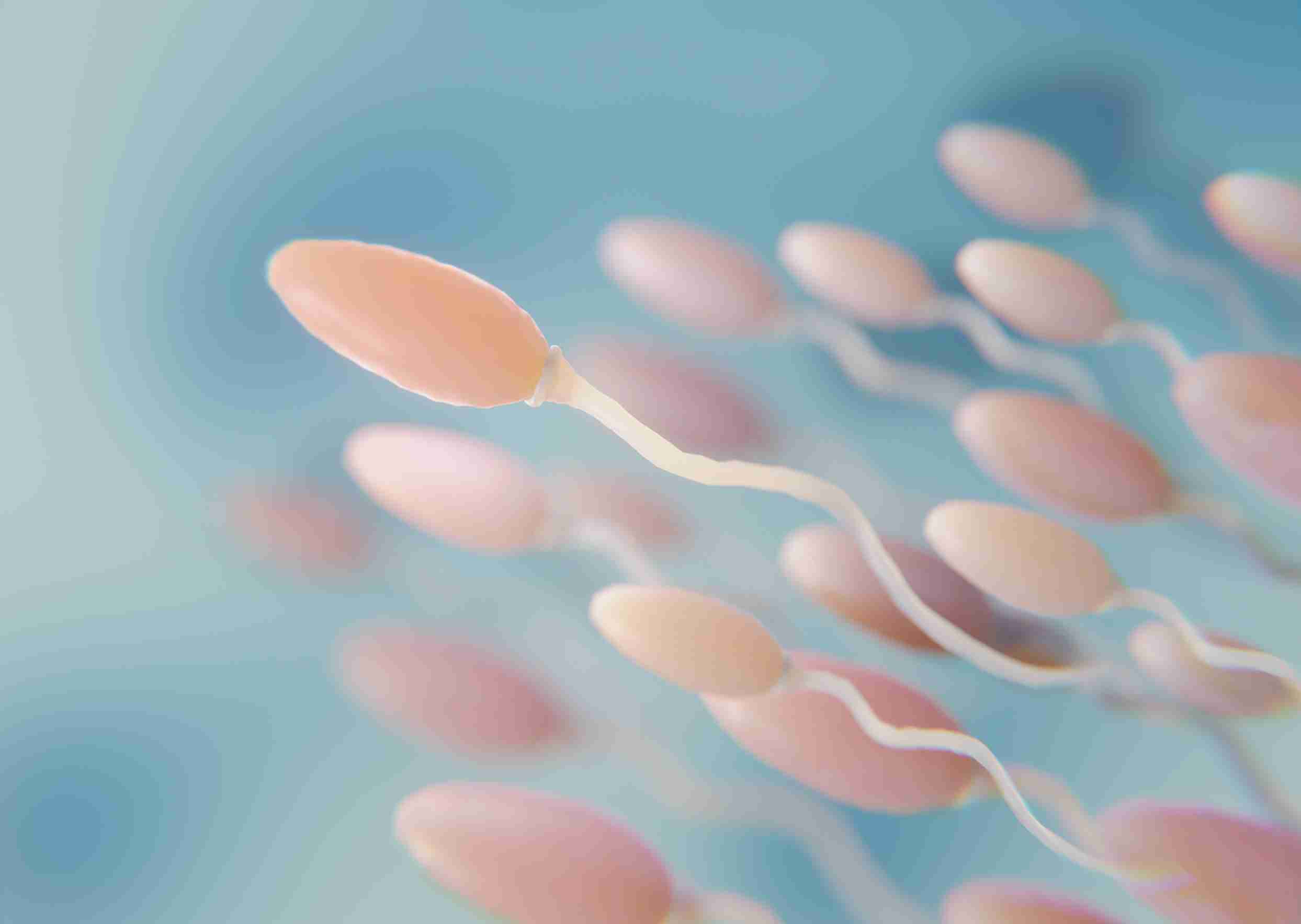 What causes azoospermia?