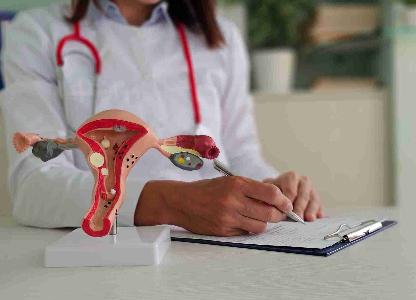 diagnostic HSG test for the fallopian tubes