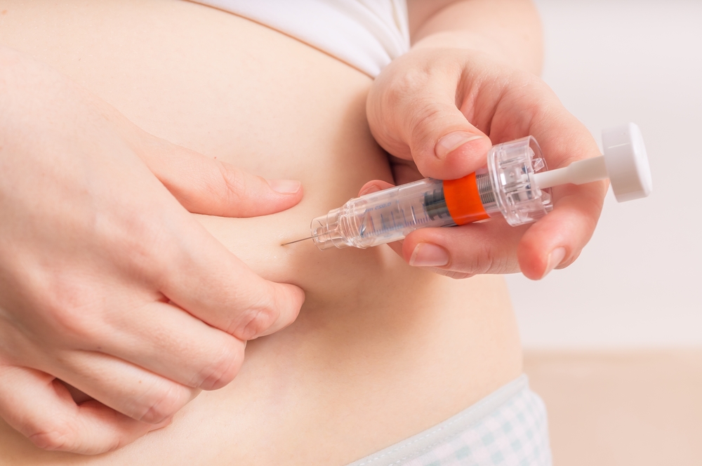intrauterine insemination (IUI)