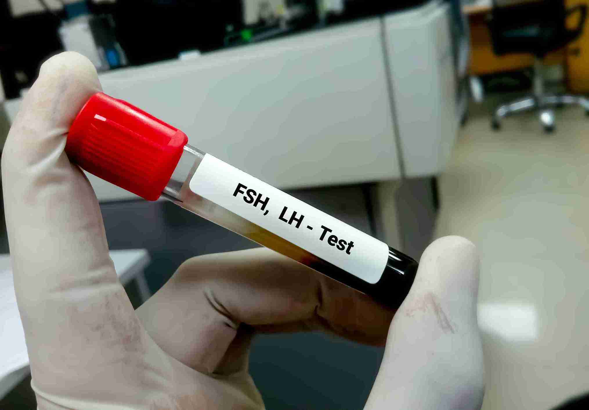 What are Hypopituitarism and What Are the Symptoms?