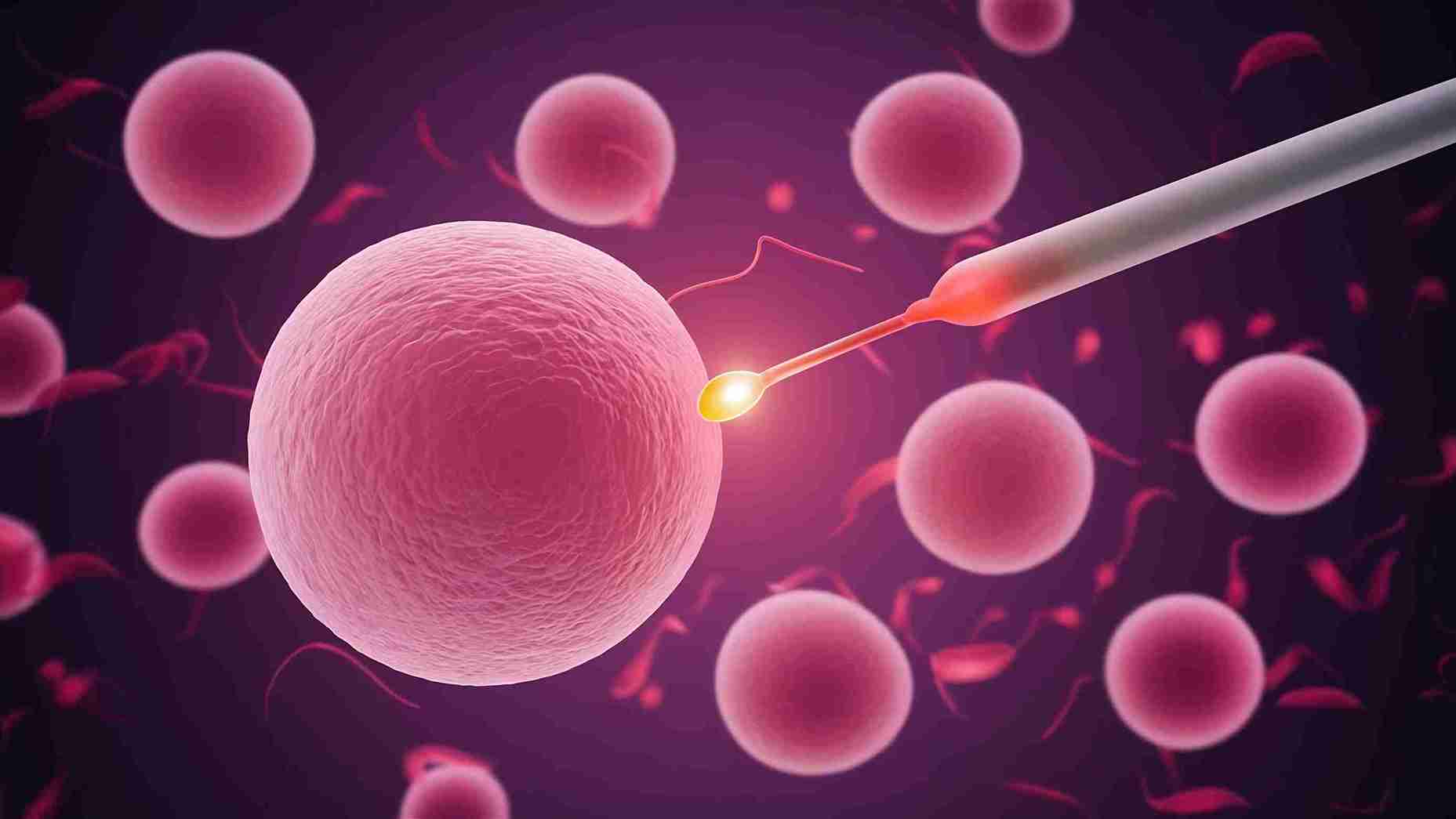 OITI (ovulation induction with timed intercourse) 