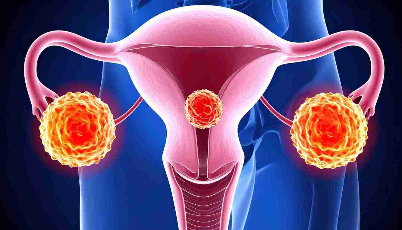 Transvaginal pelvic ultrasound showing a simple functional ovarian cyst in a woman of reproductive age in India