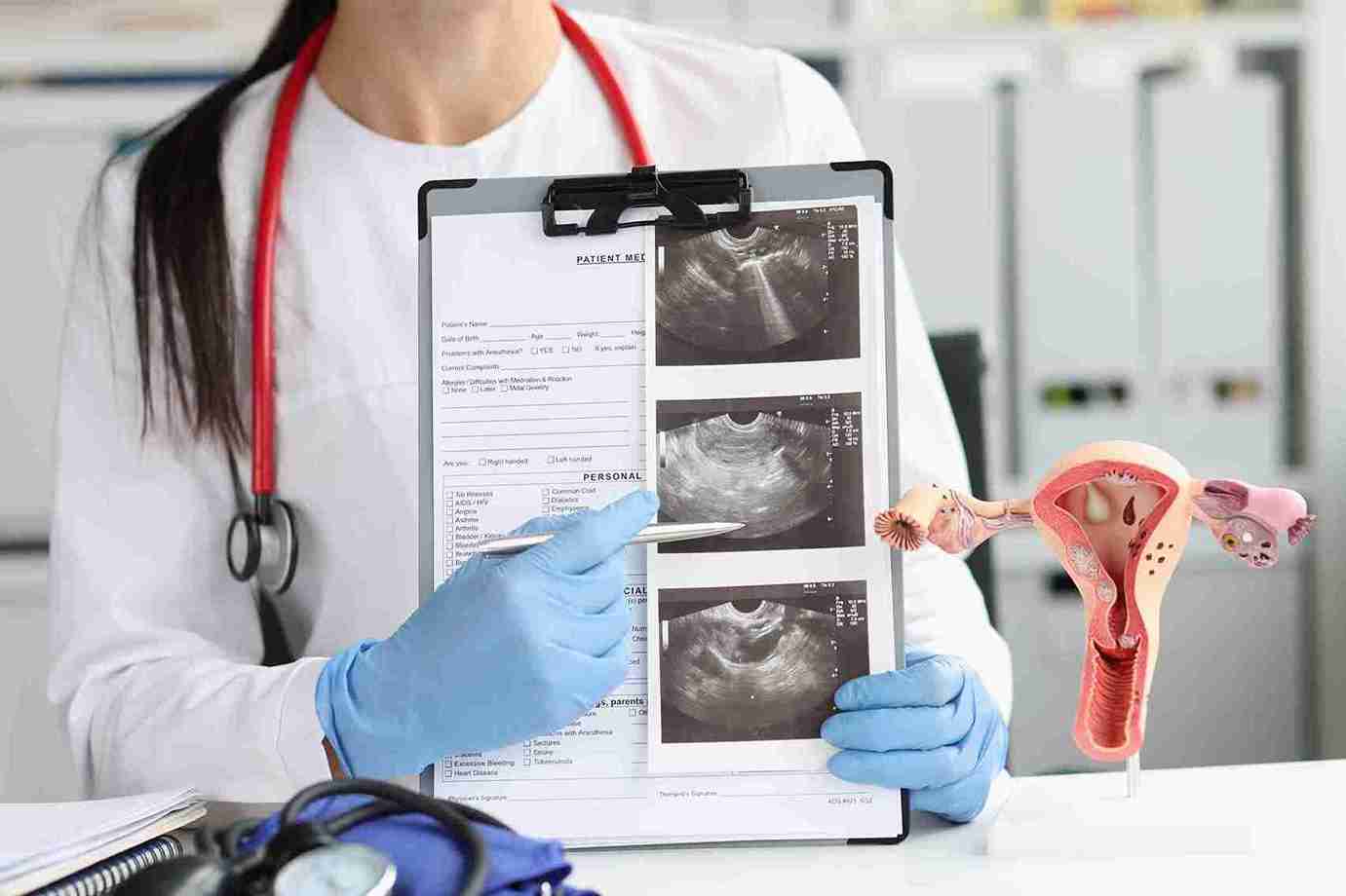 What to do if your scan shows a corpus luteum cyst