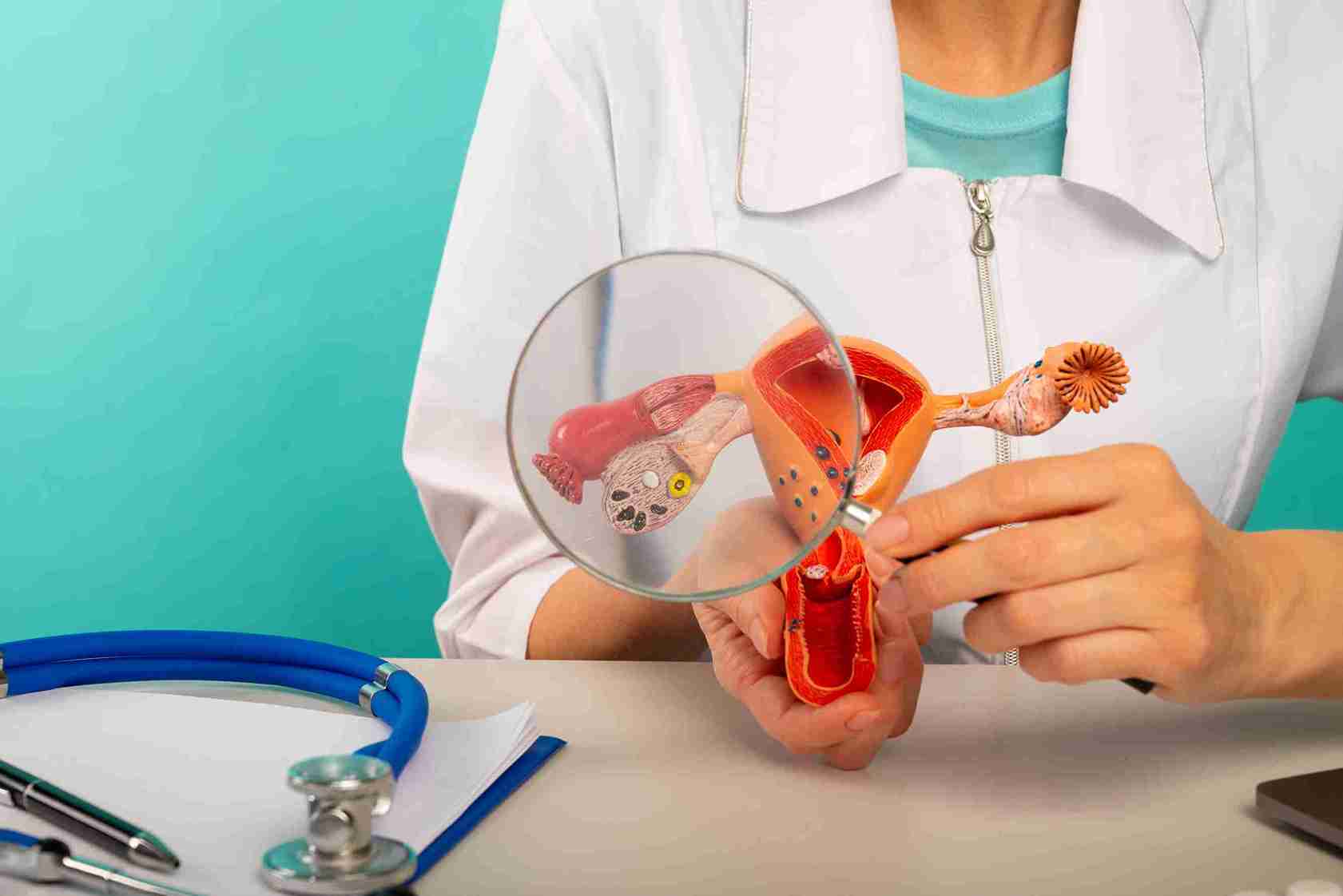 Symptoms of an ovarian cyst