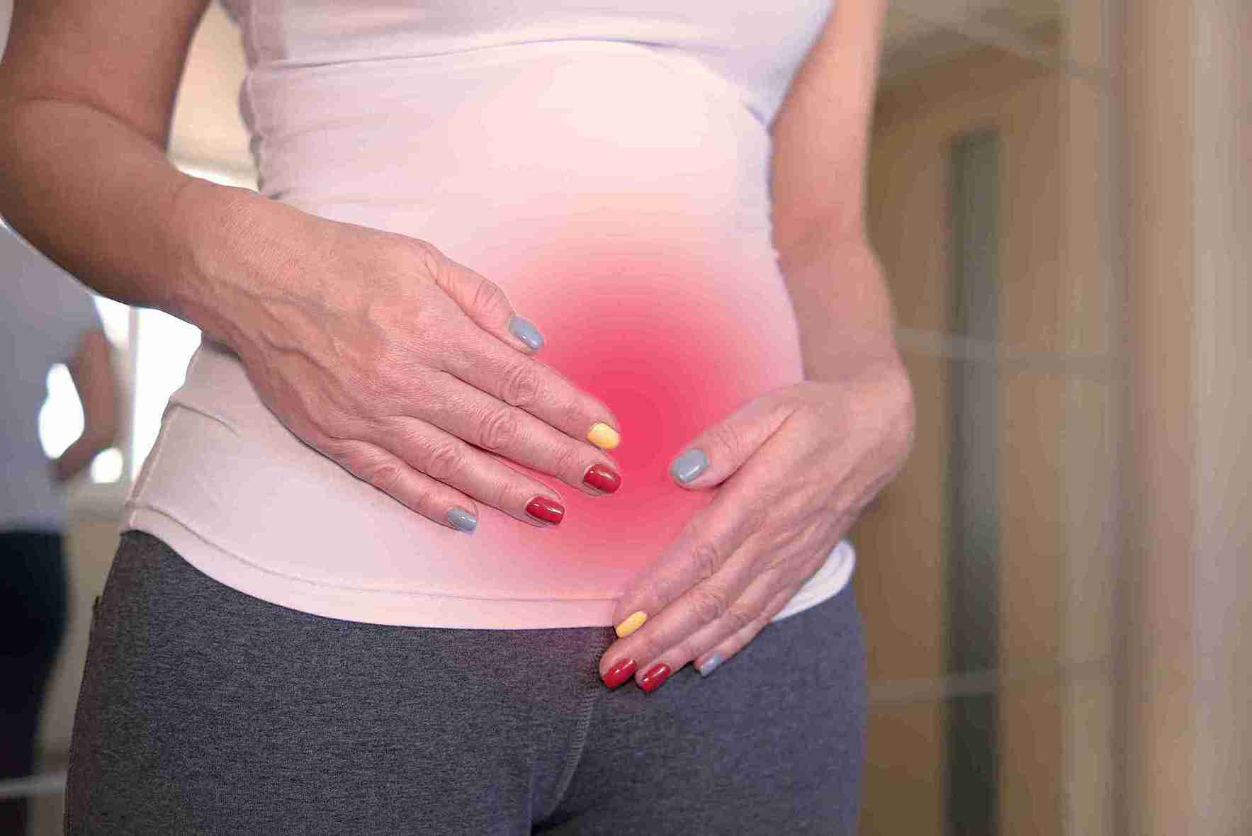 Does PCOS cause bloating?