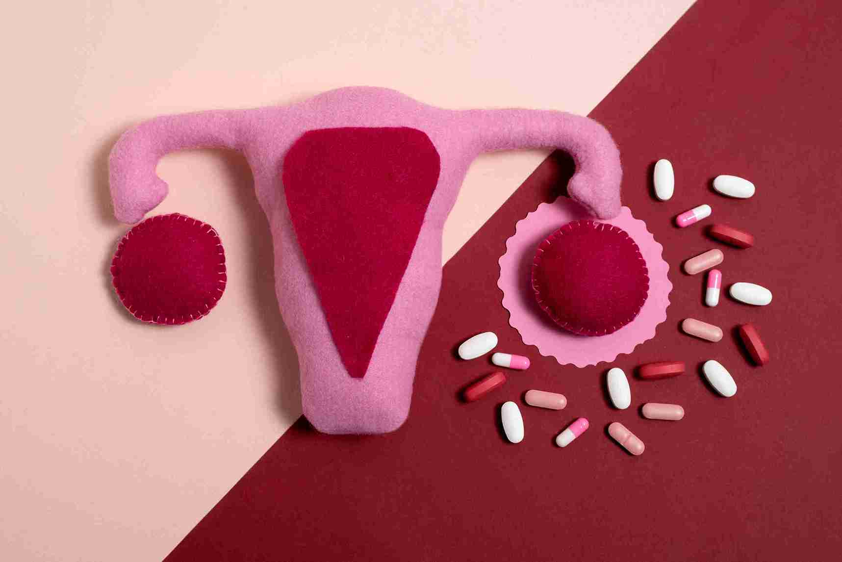 No supplement clears an ovarian cyst
