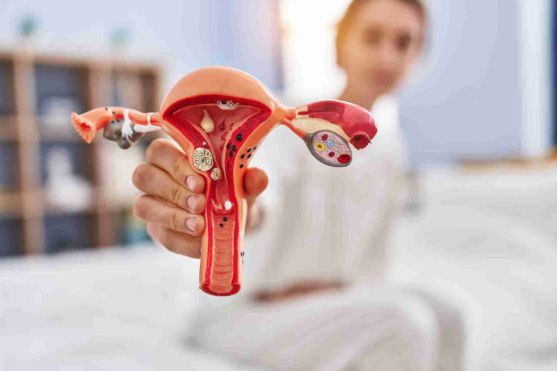 How common is it to have an ovarian cyst and not know?