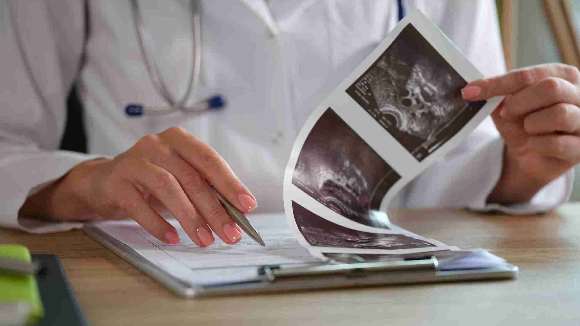 Ovarian-Adnexal Reporting Lexicon for Ultrasound