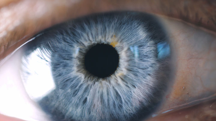 Augen lasern