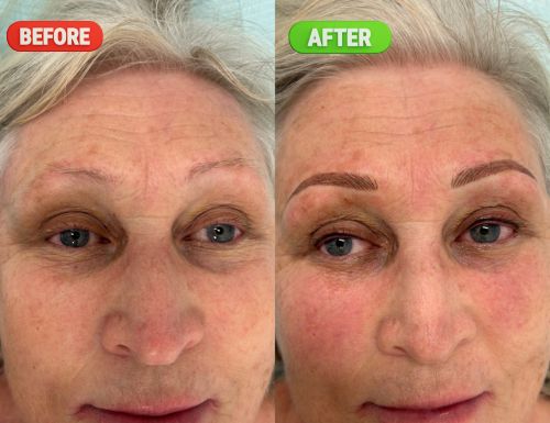 microblading-before-after-photo