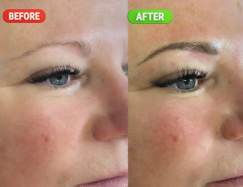 microblading-before-after-medi-spa