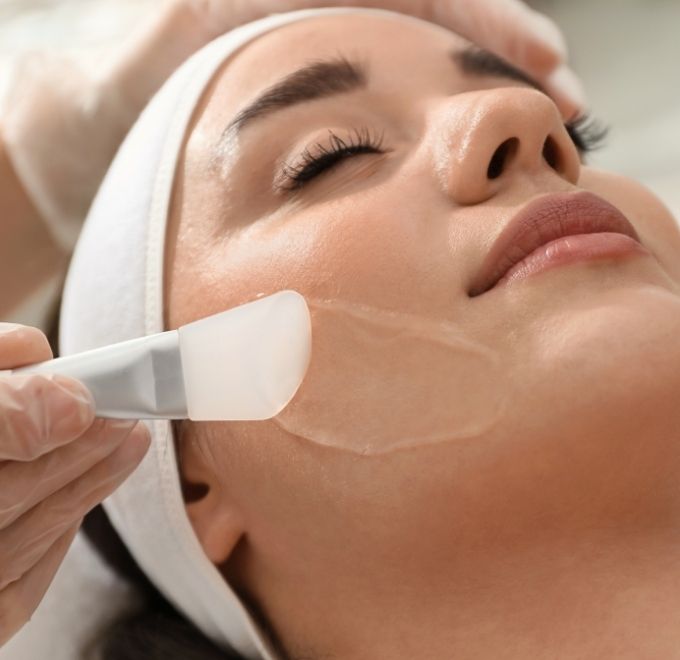 chemical-peel-victoria-sidney