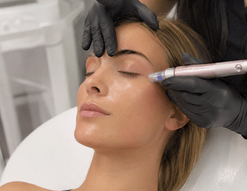 standard microneedling