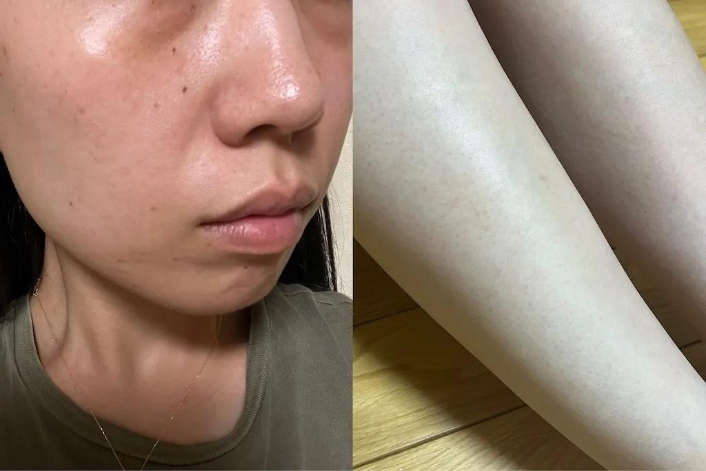 家庭用脱毛器 Ulike レビュー