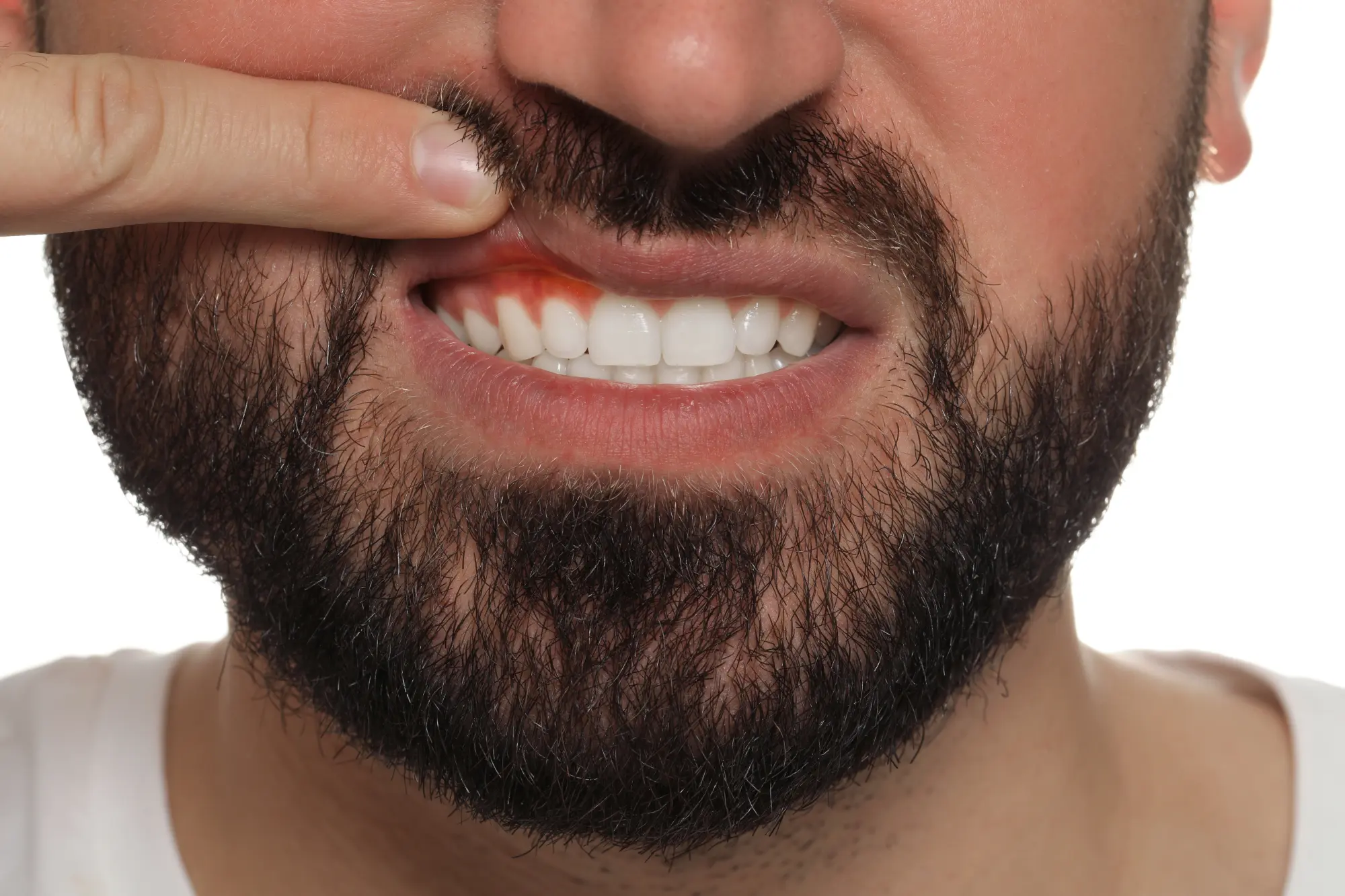 dentures in corona