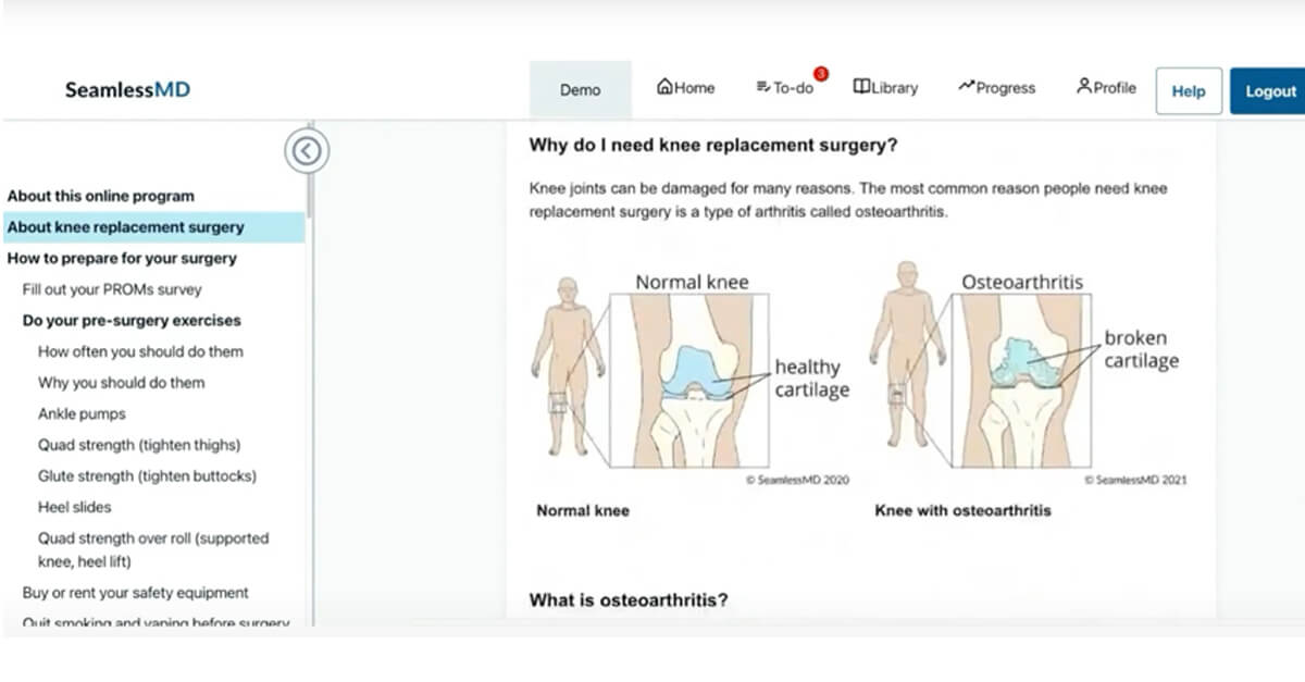 Product Demo: Supporting Patients Through Hip and Knee Replacement with SeamlessMD