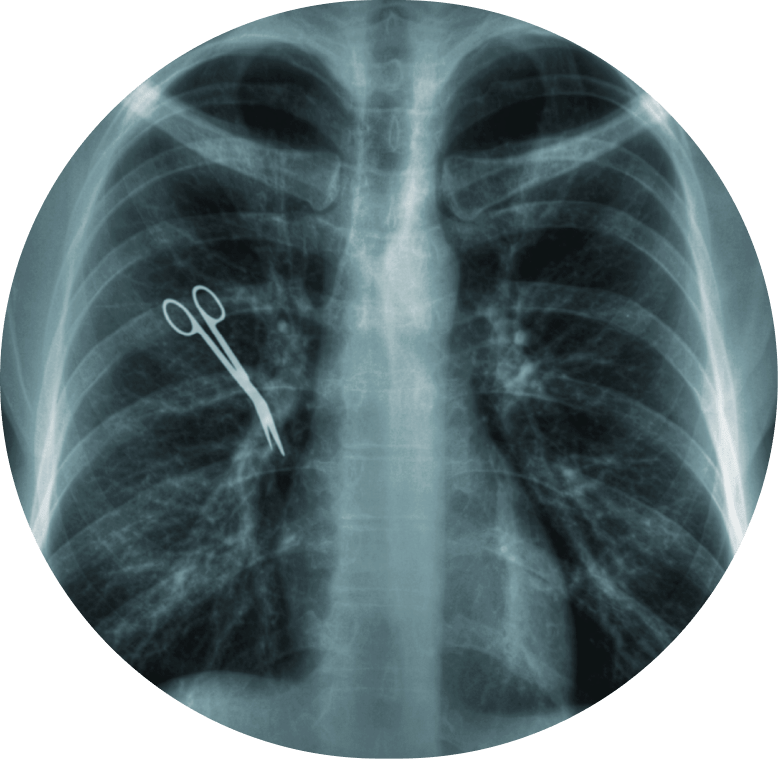 X-ray image
