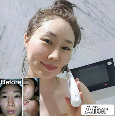máy rửa mặt lumispa nuskin