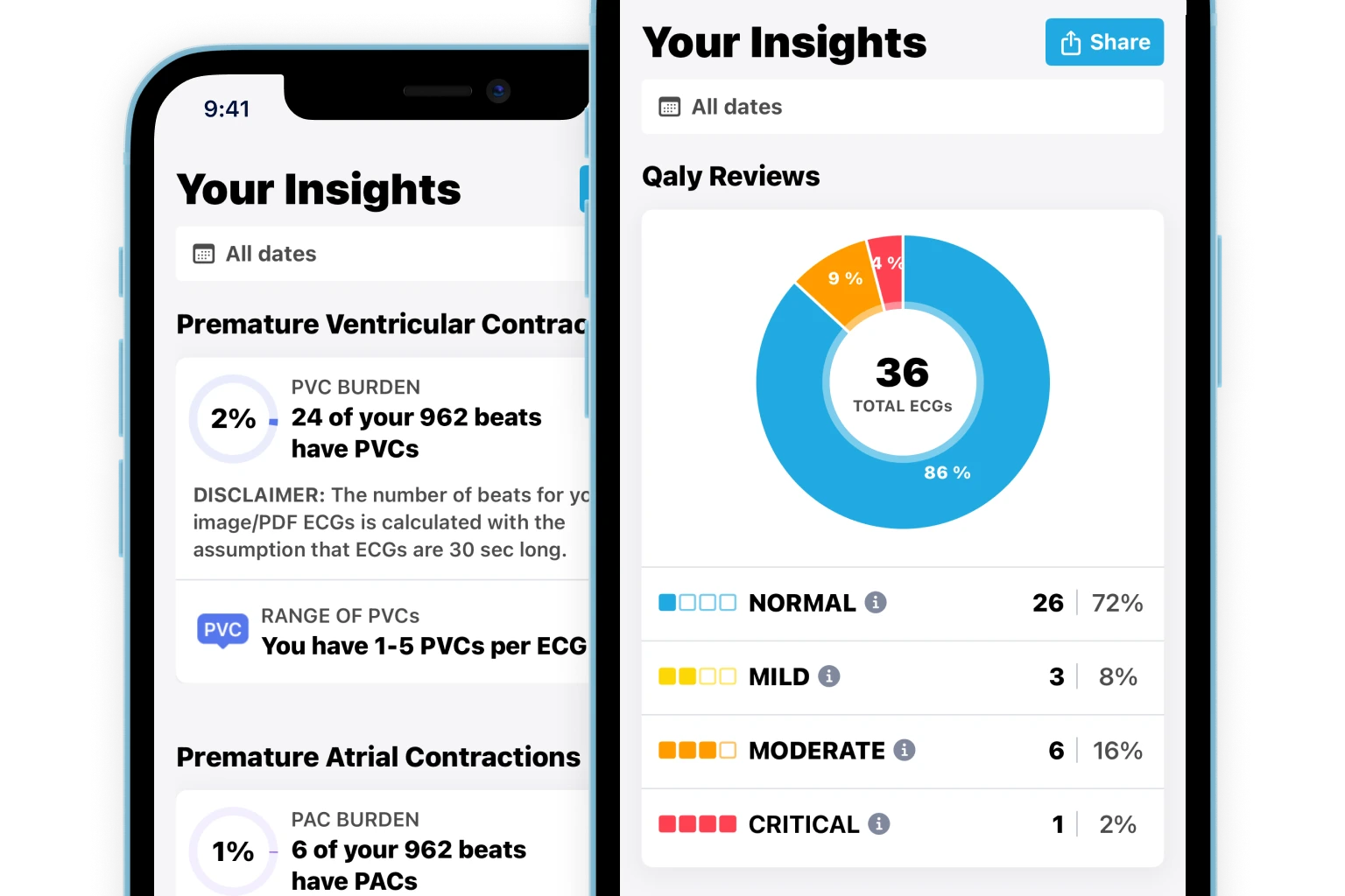 AI ECG analysis, ai ecg interpretation, PR interval trend, qrs interval trend, qtc interval trend