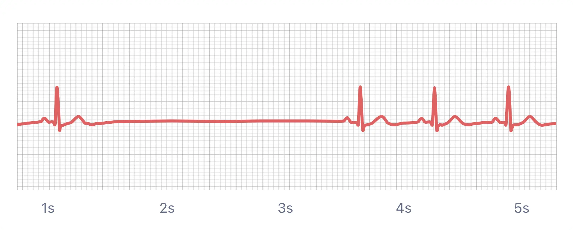 https://cdn.prod.website-files.com/60b553829ae790f1371bfcf1/63f699e1f910e002d6d45202_sinus-pause-3-1-min%20%281%29.webp