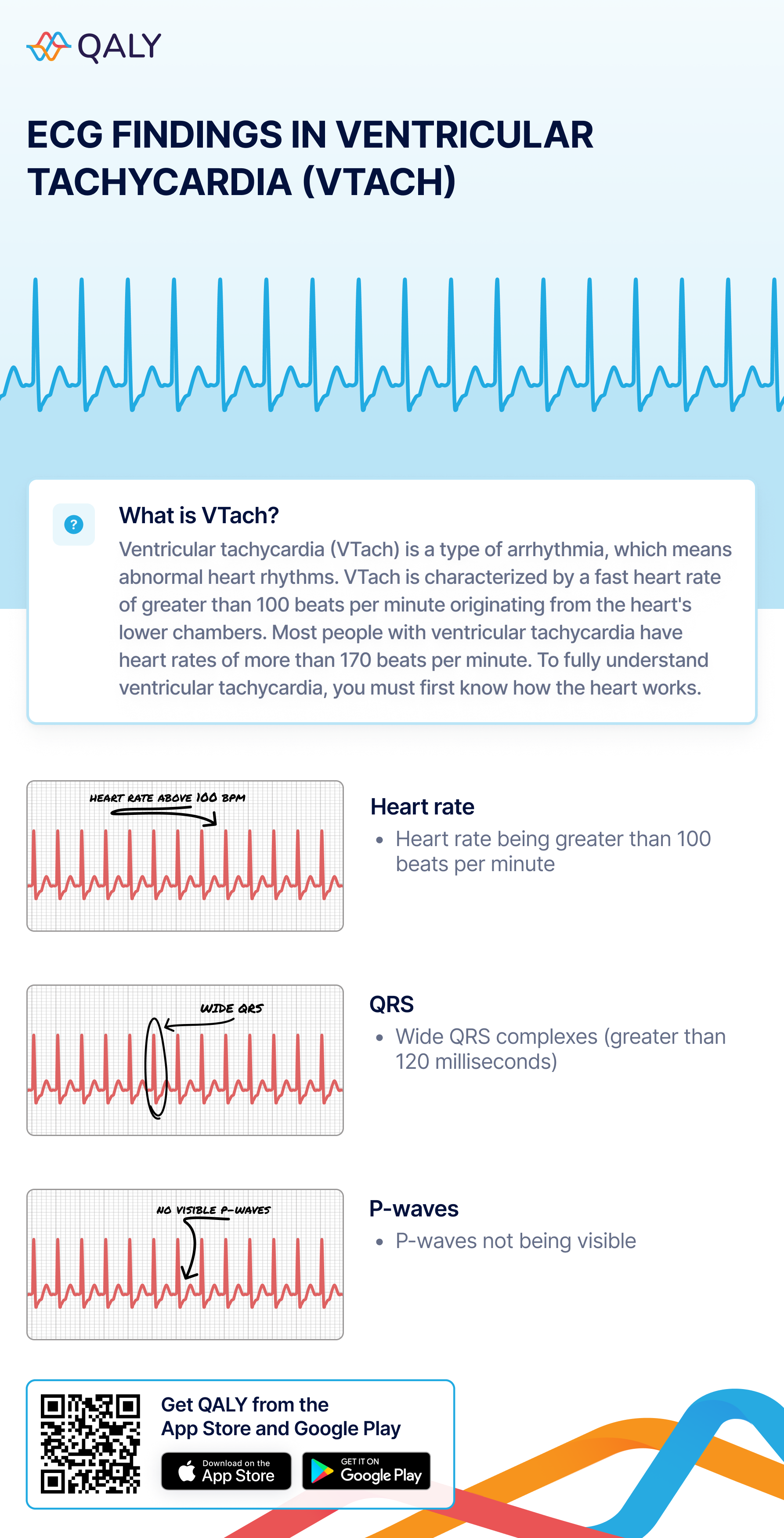 Ventricular Tachycardia Ecg What Is Tachycardia Symptoms Causes Ventricular Tachycardia Ecg What Is Tachycardia Symptoms Causes