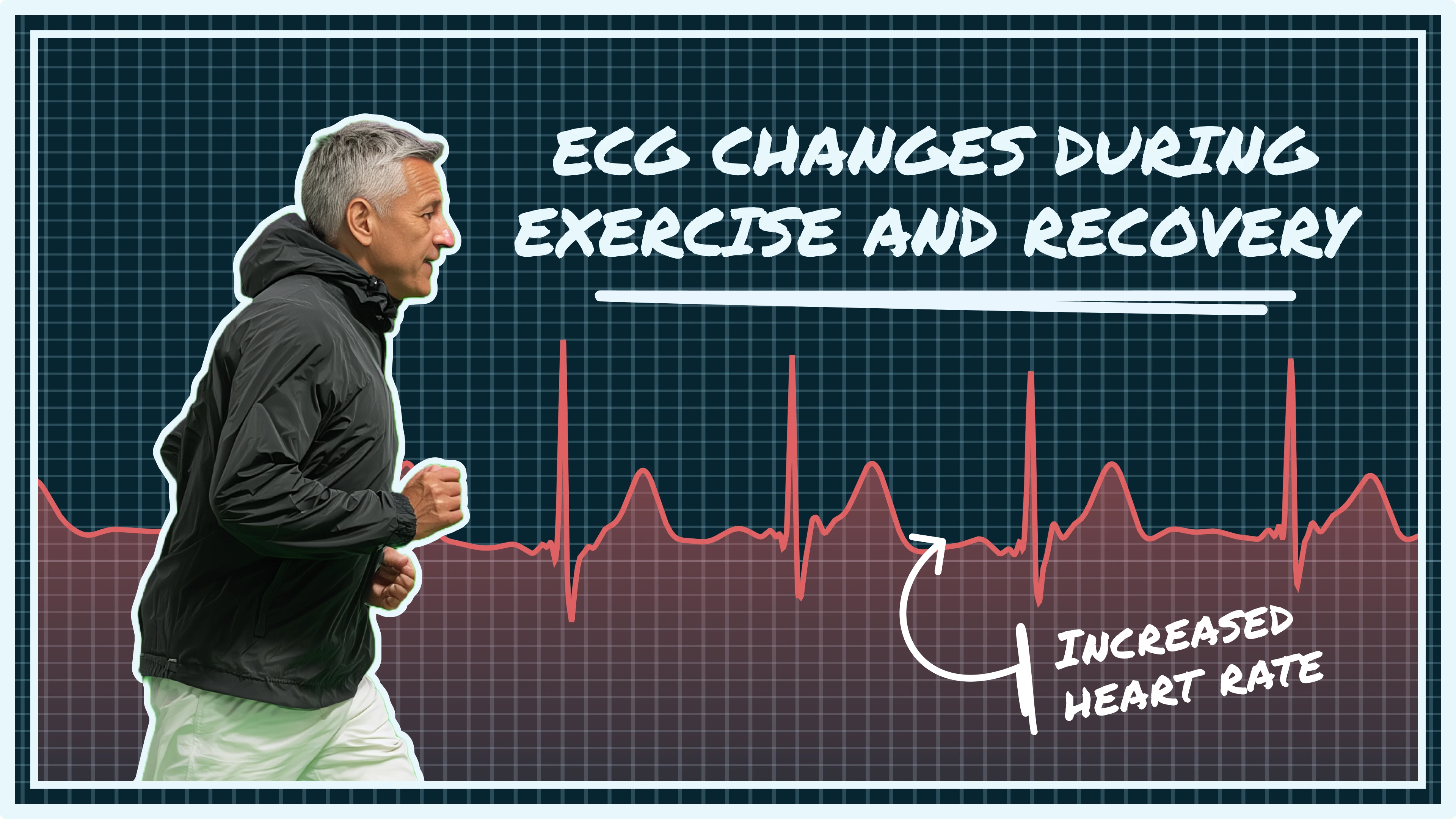 exercise ECG changes, exercise stress test, heart rate recovery, exercise-induced arrhythmias, ST segment exercise, chronotropic incompetence, wearable ECG exercise, treadmill test ECG, exercise heart monitoring, cardiac stress testing