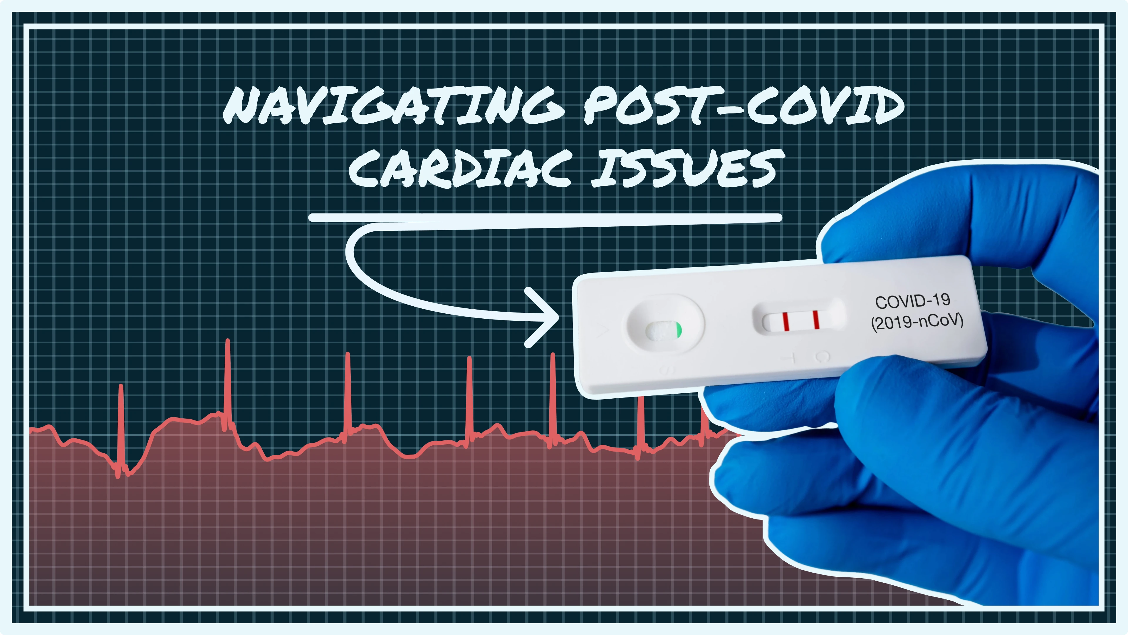 post-COVID cardiac issues, Long COVID heart symptoms, COVID-19 ECG changes, myocarditis after COVID, POTS after COVID, post-COVID palpitations, cardiac PASC, COVID heart recovery, smartwatch ECG COVID, post-viral fatigue heart