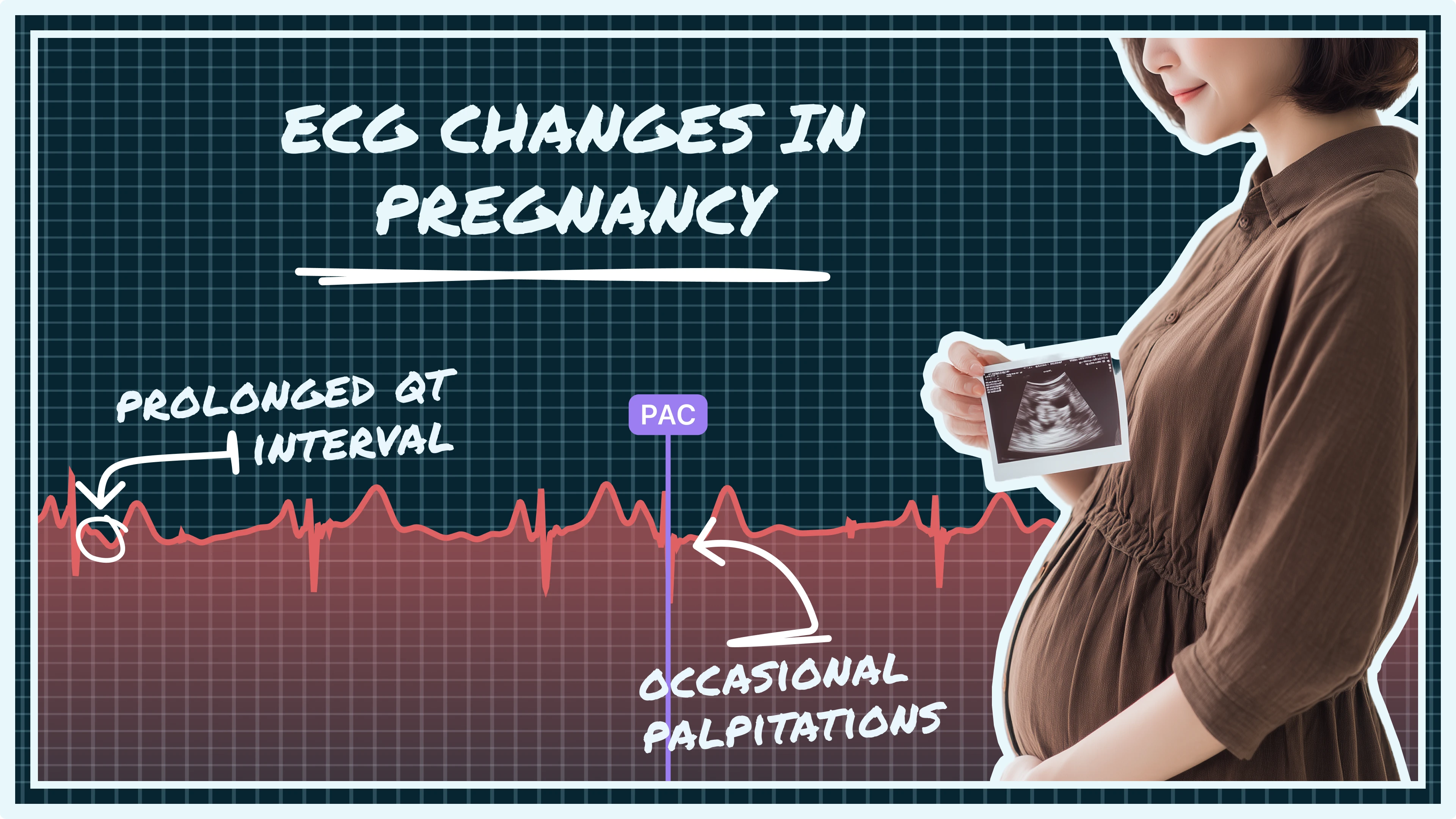 ECG changes pregnancy, heart health pregnancy, pregnancy arrhythmias, peripartum cardiomyopathy, gestational hypertension ECG, pregnant heart rate, maternal cardiac health, smartwatch ECG pregnancy, normal ECG pregnancy, abnormal ECG pregnancy