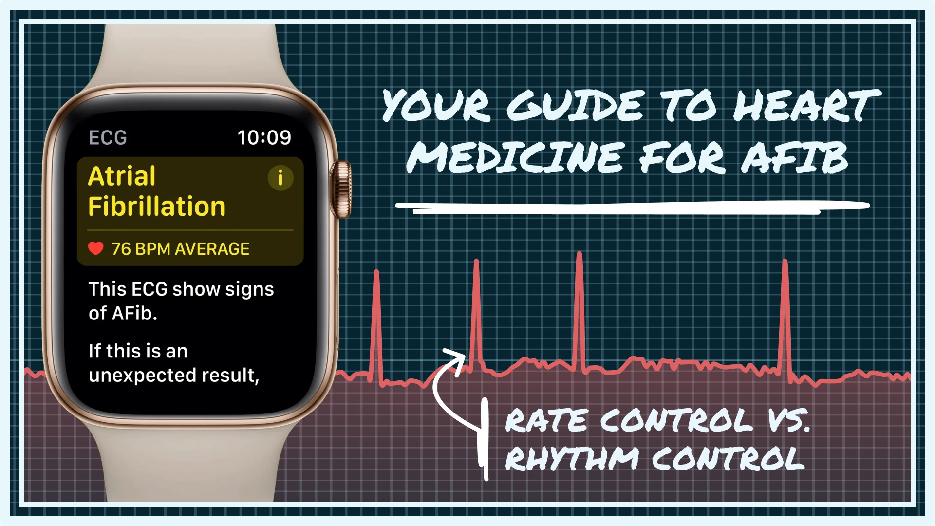 Feeling overwhelmed by AFib? This guide explains heart medicine for AFib in simple terms. Learn about your options and regain control of your health.