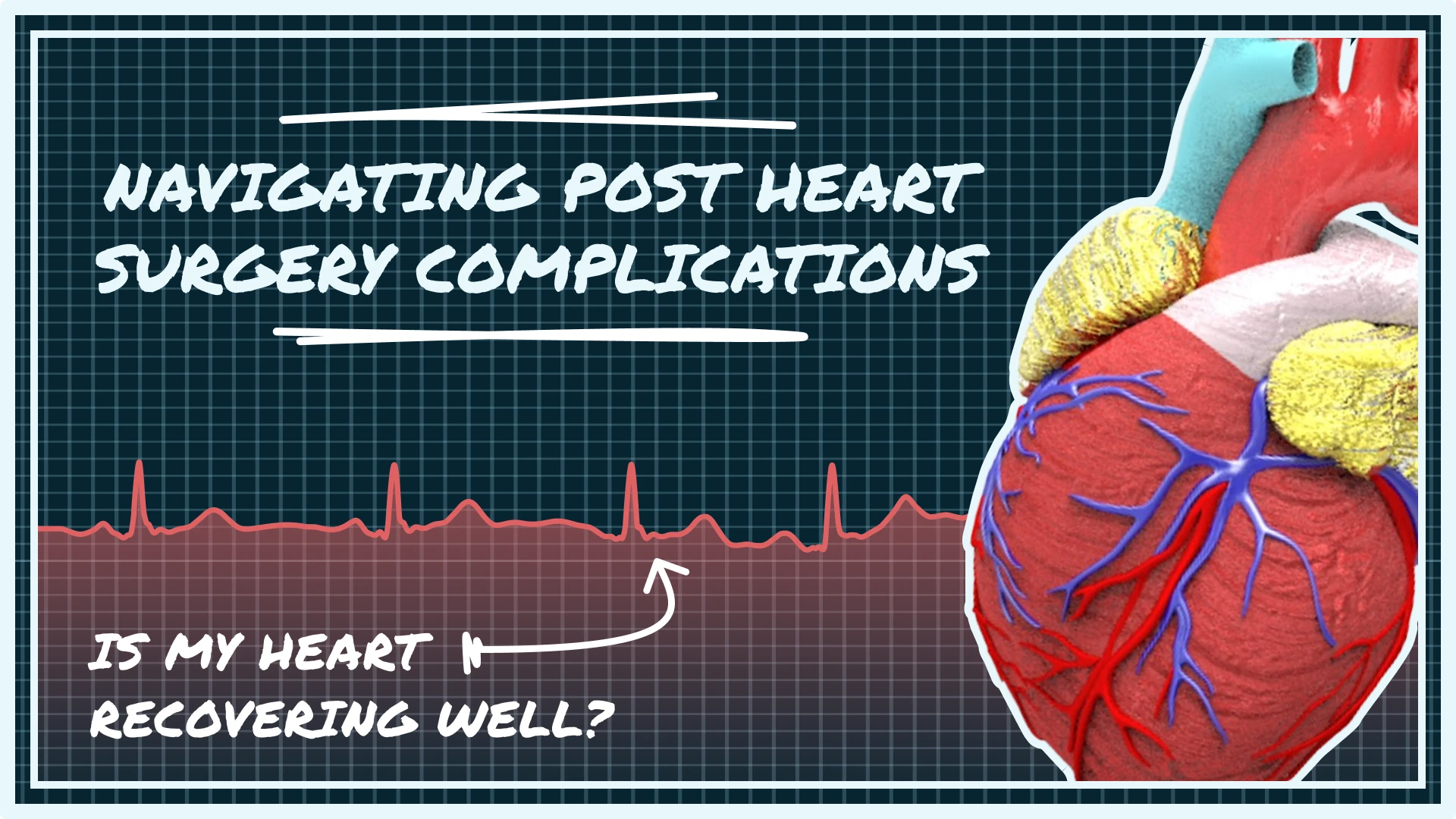 Understand post heart surgery complications, their signs, and how to manage them. Our guide offers clear, reassuring advice for a confident recovery.