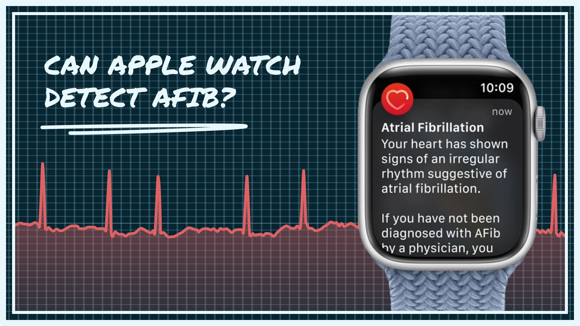 Can Apple Watch detect AFib? Understand how its ECG and heart rhythm features work, their accuracy, and what the notifications really mean for your health.