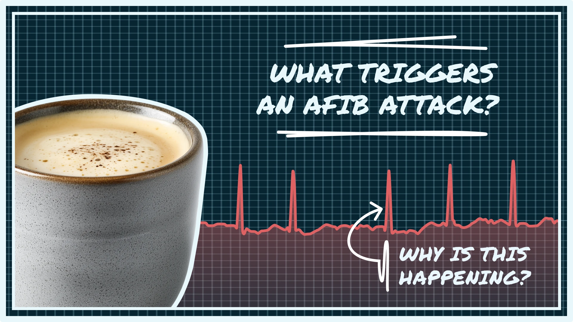 Learn what triggers an AFib attack, including stress, diet, and sleep issues. Discover ways to reduce risks and protect your heart health today.